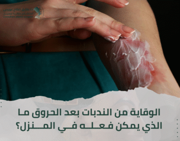 علاج الحروق جدة