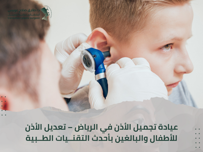 تجميل الأذن الرياض