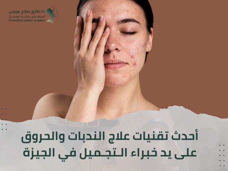 علاج الندبات