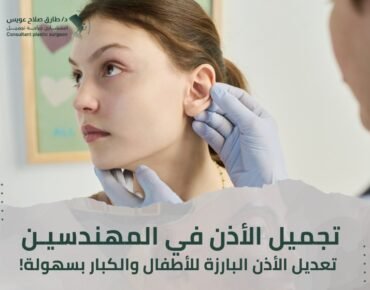 تجميل الأذن المهندسين