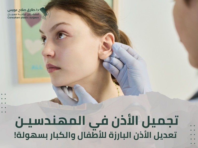تجميل الأذن المهندسين