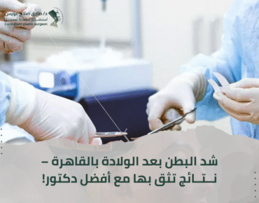 أفضل دكتور شد البطن