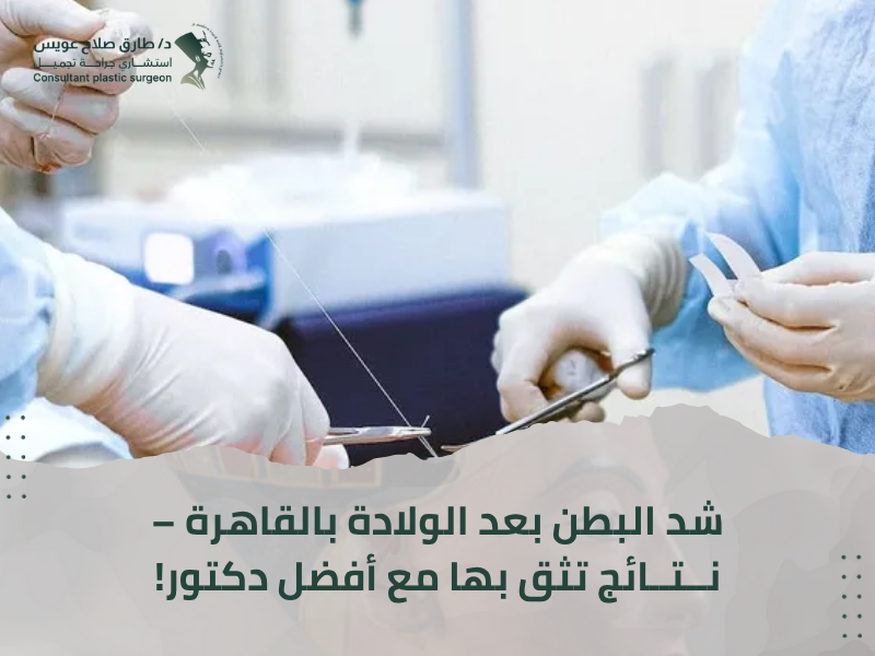 أفضل دكتور شد البطن